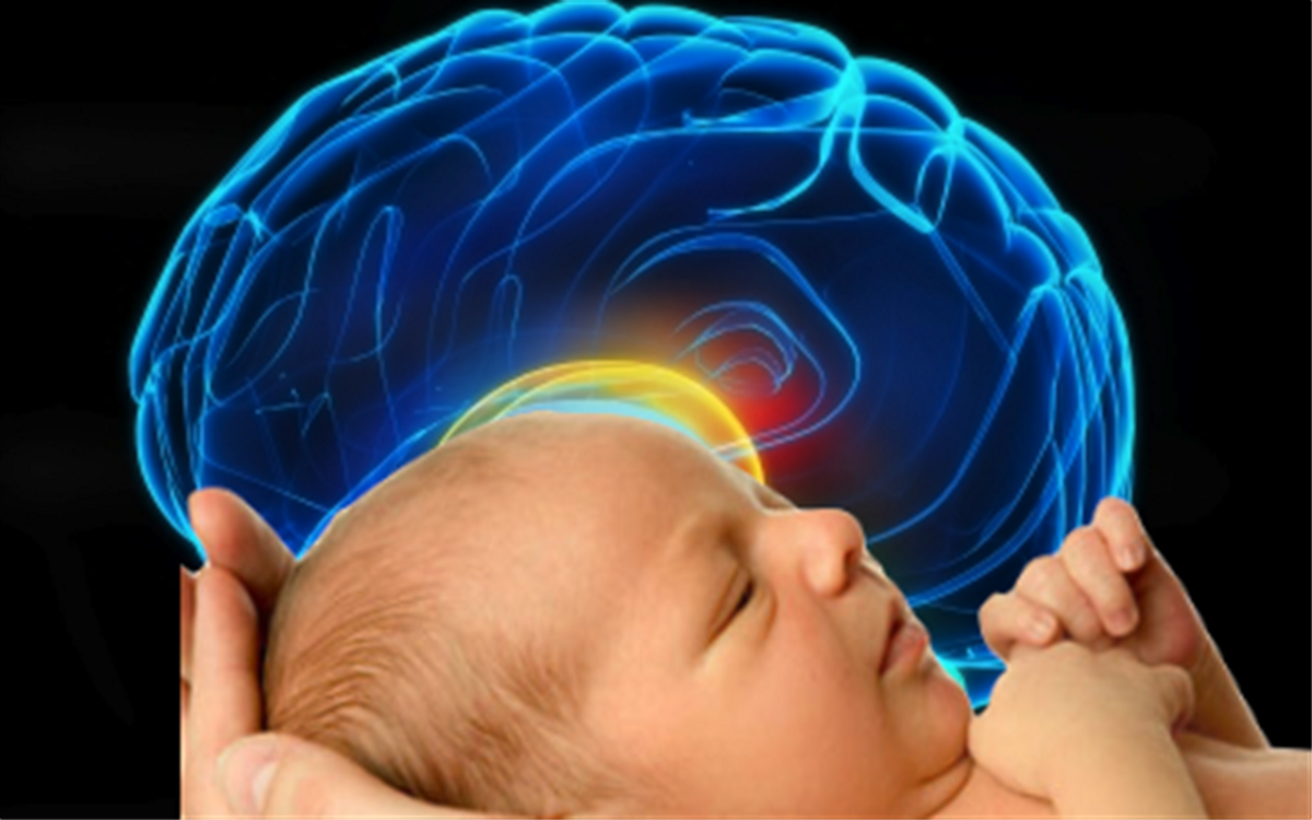 Нарушение развития головного мозга. Мозг ребенка. Нервная система ребенка.