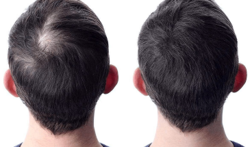 Средства для объема волос: секрет пышных причесок